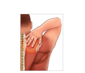 dolor muscular