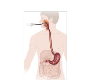 endoscopia digestiva