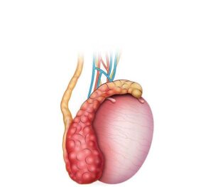 epididimitis testicular