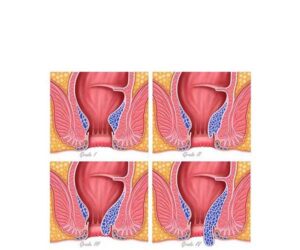 ilusmedical.com