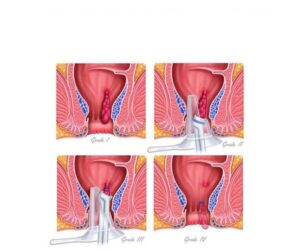 ilusmedical.com
