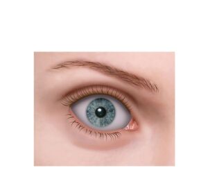 eyes exophthalmos thyroid