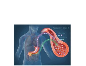 glucosa e insulina en diabetes tipo 1