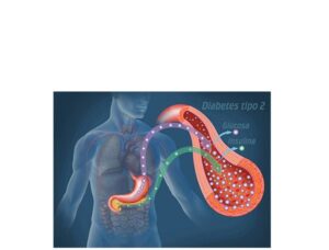 glucosa e insulina en diabetes tipo 2