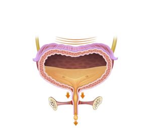 incontinencia musculos esfinter debil