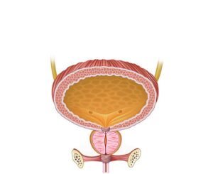 incontinencia urinaria agrandamiento de prostata