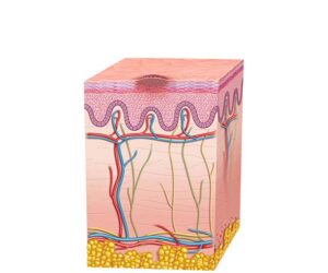inicio del melanoma