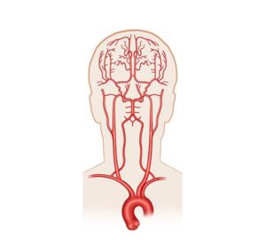 flujo sanguíneo cerebral
