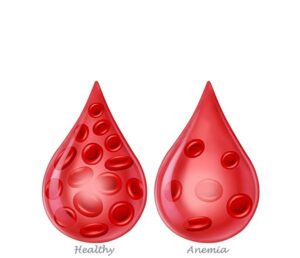 la sangre en anemia