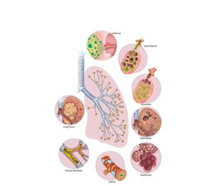 respiratory disorders