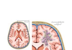 ilusmedical.com