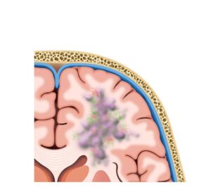 ilusmedical.com