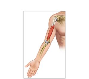 muscular atrophy