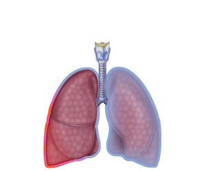 pulmonary pleural effusion