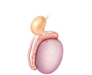 quiste testicular