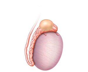 quiste de testiculo