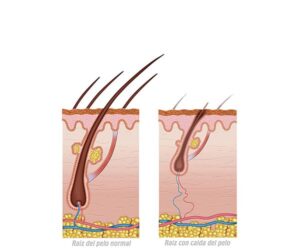1512.m00.i121.n045.p.c25.311526266 hair growth cycle