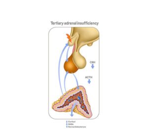 tertiary adrenal insufficiency