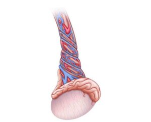 torsión testicular