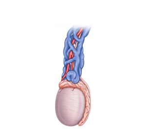 varicocele testicular